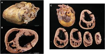 Natural History of Histopathologic Changes in Cardiomyopathy of Golden Retriever Muscular Dystrophy